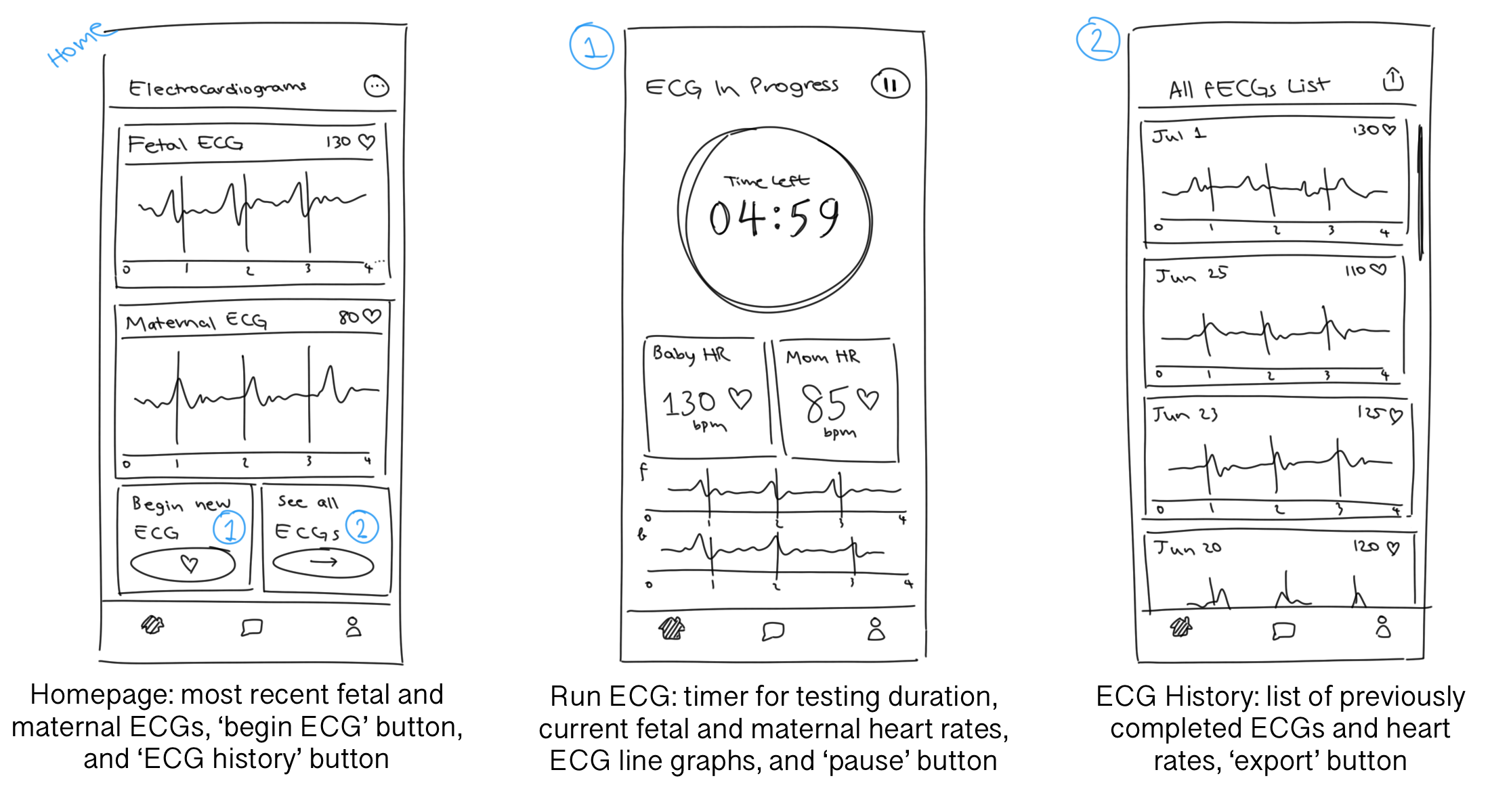 View ECGs Sketch Screens